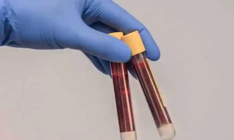  你的血管正在被悄悄侵蚀：那个你以为安全的血脂数字，可能已经害了你 健康养生